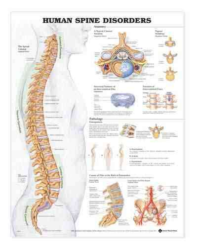 Human Spine Disorders Anatomical Chart  20  x 26
